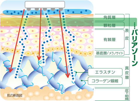 エレクトロポレーションのご案内 サンソリット 医療機関様向けサイト